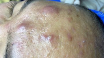 [ID: GsiNaaL6K68] Youtube Automatic